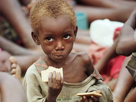 Fast%20jedes%20zweite%20Kinde%20leidet%20an%20Hunger.jpg